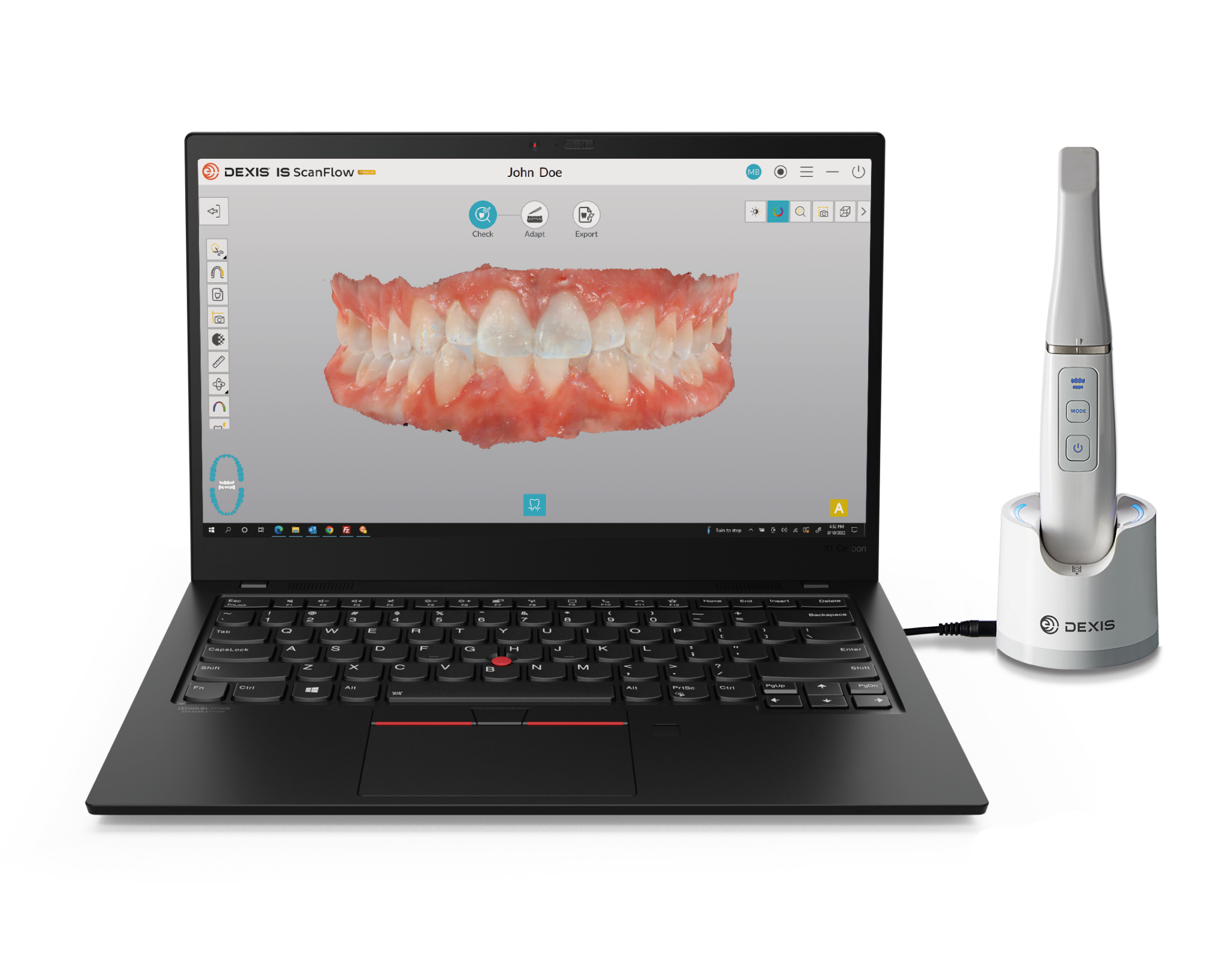 Laptop mit scann auf Bildschrim Dexis Scanner daneben