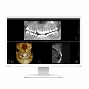 Modulare Erweiterungen des RayScan Alpha Plus: Cephalometrie- und Panorama-Module