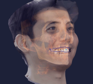 RayFace Smile Design