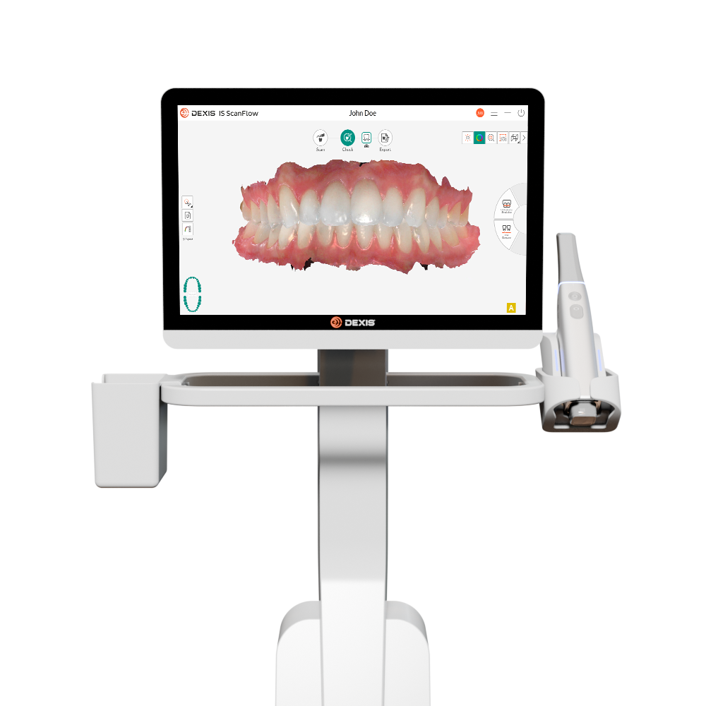 Dexis Impreco mit Cart und Laptop