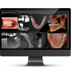 Key Visual without findings (1)