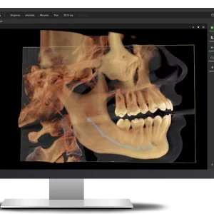 grow-your-diagnostic-capabilities-with-3d-imaging.png